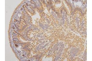 IHC analysis of RAB3GAP2 using anti-RAB3GAP2 antibody (ABIN6719633).