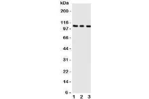 Western blot testing of ADAMTS1 antibody;  Lane 1: rat liver;  2: (r) heart;  3: (r) brain tissue lysate.