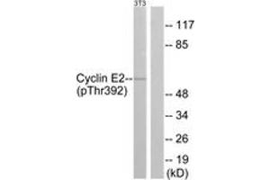 Western Blotting (WB) image for anti-Cyclin E2 (CCNE2) (AA 355-404), (pThr392) antibody (ABIN482177) (Cyclin E2 antibody  (pThr392))