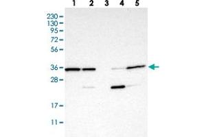Western blot analysis of Lane 1: RT-4, Lane 2: U-251 MG, Lane 3: Human Plasma, Lane 4: Liver, Lane 5: Tonsil with C7orf20 polyclonal antibody .