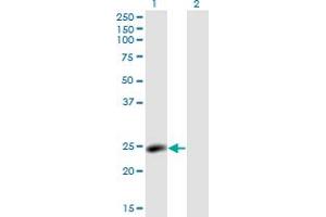 Western Blot analysis of LYPLA2 expression in transfected 293T cell line by LYPLA2 monoclonal antibody (M01), clone 3H5. (LYPLA2 antibody  (AA 144-231))