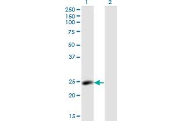 LYPLA2 antibody  (AA 144-231)