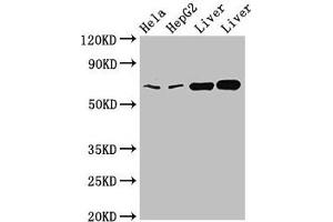 Western Blot Positive WB detected in: Hela whole cell lysate, HepG2 whole cell lysate, Rat liver tissue, Mouse liver tissue All lanes: CLINT1 antibody at 2 μg/mL Secondary Goat polyclonal to rabbit IgG at 1/50000 dilution Predicted band size: 69, 71 kDa Observed band size: 69 kDa (CLINT1 antibody  (AA 1-625))