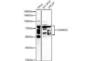 Western blot analysis of extracts of various cell lines, using C antibody (ABIN6130036, ABIN6137894, ABIN6137895 and ABIN6225248) at 1:500 dilution. (CAMKK2 antibody  (AA 1-140))