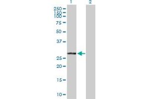 Western Blot analysis of VAPB expression in transfected 293T cell line by VAPB MaxPab polyclonal antibody. (VAPB antibody  (AA 1-243))