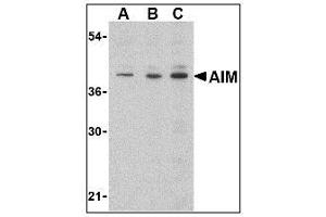 Image no. 1 for anti-CD5 Molecule-Like (CD5L) (C-Term) antibody (ABIN200118) (CD5L antibody  (C-Term))