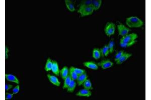 Immunofluorescent analysis of HepG2 cells using ABIN7158804 at dilution of 1:100 and Alexa Fluor 488-congugated AffiniPure Goat Anti-Rabbit IgG(H+L) (LAMP2 antibody  (AA 54-268))