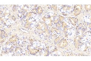 Detection of SPHK1 in Human Stomach Tissue using Polyclonal Antibody to Sphingosine Kinase 1 (SPHK1)