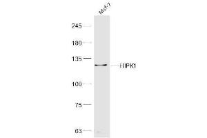MCF-7 lysates probed with HIPK1 Polyclonal Antibody, Unconjugated  at 1:300 dilution and 4˚C overnight incubation. (HIPK1 antibody  (AA 1-100))