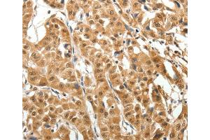 Immunohistochemistry (IHC) image for anti-Microtubule-Associated Protein 1A (MAP1A) antibody (ABIN5546309)