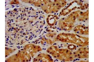 IHC image of ABIN7152853 diluted at 1:500 and staining in paraffin-embedded human kidney tissue performed on a Leica BondTM system. (FGFRL1 antibody  (AA 403-470))