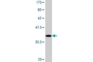 Western Blot detection against Immunogen (36. (DHX8 antibody  (AA 301-400))