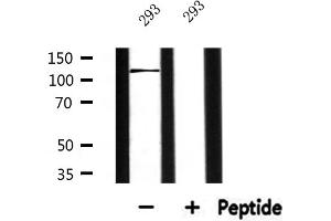 Western blot analysis of extracts from 293, using ATXN2L Antibody. (Ataxin 2-Like antibody  (Internal Region))