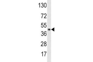 Western blot analysis of SKP2 antibody and HeLa lysate. (SKP2 antibody  (AA 156-185))