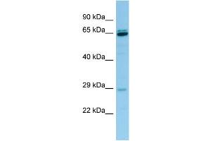 WB Suggested Anti-PRB3 Antibody Titration: 1. (PRB3 antibody  (Middle Region))