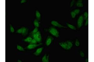 Immunofluorescent analysis of Hela cells using ABIN7148556 at dilution of 1:100 and Alexa Fluor 488-congugated AffiniPure Goat Anti-Rabbit IgG(H+L) (COBLL1 antibody  (AA 1-106))