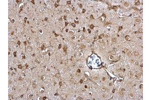 Immunohistochemistry (IHC) image for anti-Protein Disulfide Isomerase Family A, Member 3 (PDIA3) (C-Term) antibody (ABIN2854699)