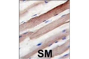 Formalin-fixed and paraffin-embedded human skeletal muscle reacted with Autophagy G4B Antibody  1809d , which was peroxidase-conjugated to the secondary antibody, followed by DAB staining. (ATG4B antibody  (AA 258-284))