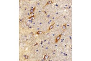 Immunohistochemical analysis of paraffin-embedded R. (CNR2 antibody  (C-Term))