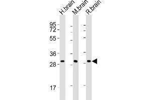 KCNMB2 抗体  (C-Term)