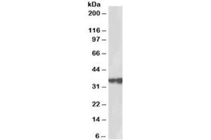 Western blot testing of human testis lysate with HSD17B3 antibody at 2ug/ml. (HSD17B3 antibody)