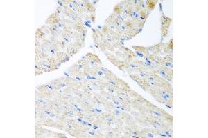 Immunohistochemistry of paraffin-embedded mouse heart using G antibody (ABIN6129967, ABIN6140880, ABIN6140881 and ABIN6223736) at dilution of 1:200 (40x lens).
