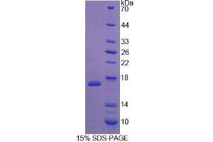 SDS-PAGE analysis of Mouse WISP1 Protein.