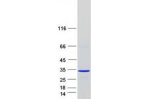Western Blotting (WB) image for RAS-Like, Estrogen-Regulated, Growth Inhibitor (RERG) protein (Myc-DYKDDDDK Tag) (ABIN2730724)