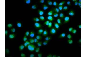 Immunofluorescence staining of Hela cells with ABIN7165653 at 1:100, counter-stained with DAPI. (INTU antibody  (AA 6-139))