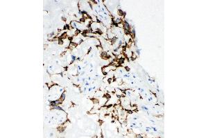 Anti-HYAL1 antibody,  IHC(F) IHC(F): Human Placenta Tissue
