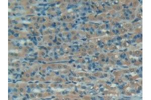 Immunohistochemistry (IHC) image for anti-Serpin Peptidase Inhibitor, Clade G (C1 Inhibitor), Member 1 (SERPING1) (AA 148-270) antibody (ABIN7431434)