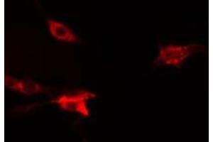 ABIN6275831 staining  Hela cells by IF/ICC. (TRAF2 antibody  (C-Term))