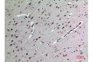Immunohistochemistry (IHC) analysis of paraffin-embedded Human Brain, antibody was diluted at 1:100. (Midkine antibody  (Internal Region))