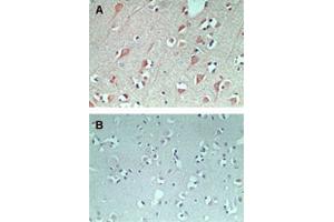 IHC staining of FAM3C using FAM3C polyclonal antibody  in normal human brain at 5 ug/mL (using control rabbit Ig for figure B). (FAM3C antibody  (AA 40-80))
