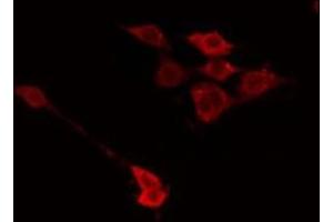 ABIN6266745 staining HuvEc by IF/ICC. (GALK1 antibody  (C-Term))