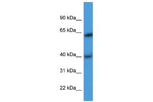 WB Suggested Anti-ARPM1 Antibody Titration: 0. (ARPM1 antibody  (N-Term))