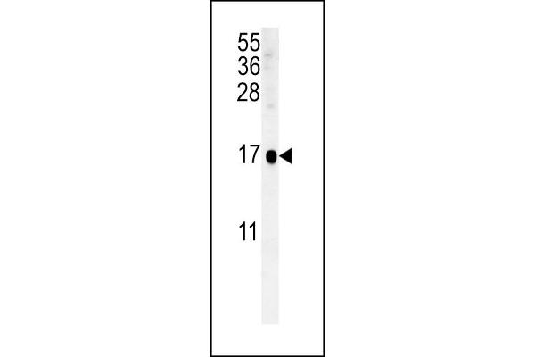 SIKE1 antibody  (C-Term)