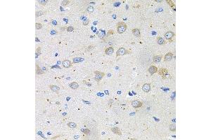 Immunohistochemistry of paraffin-embedded rat brain using GNE antibody (ABIN5996449) at dilution of 1/100 (40x lens).