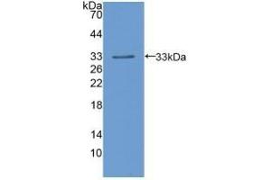 Detection of Recombinant LIPD, Human using Polyclonal Antibody to Lipoprotein lipase (LPL) (Lipoprotein Lipase antibody  (AA 55-316))