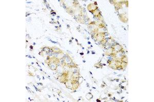 Immunohistochemistry of paraffin-embedded human stomach using IFNL3 antibody at dilution of 1:100 (40x lens). (IL28B antibody)