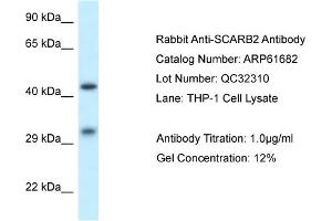 Western Blotting (WB) image for anti-Scavenger Receptor Class B, Member 2 (SCARB2) (N-Term) antibody (ABIN2788867) (SCARB2 antibody  (N-Term))