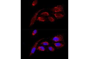 Confocal immunofluorescence analysis of U2OS cells using H Polyclonal Antibody (ABIN6131125, ABIN6137333, ABIN6137334 and ABIN6220624) at dilution of 1:100. (ATP5H antibody  (AA 1-161))