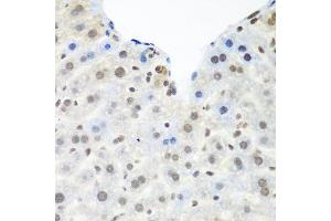 Immunohistochemistry of paraffin-embedded mouse liver using TARDBP antibody at dilution of 1:100 (40x lens).