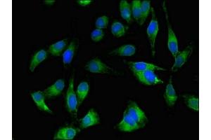 Immunofluorescent analysis of Hela cells using ABIN7174011 at dilution of 1:100 and Alexa Fluor 488-congugated AffiniPure Goat Anti-Rabbit IgG(H+L) (BTK antibody  (AA 254-443))