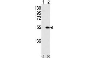 Western blot analysis of CAMK1G (arrow) using rabbit polyclonal CAMK1G (Center) Antibody . (CAMK1G antibody  (Center))