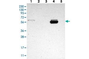 Western blot analysis of Lane 1: RT-4, Lane 2: U-251 MG, Lane 3: Human Plasma, Lane 4: Liver, Lane 5: Tonsil with ALDH1A2 polyclonal antibody .
