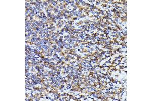 Immunohistochemistry (IHC) image for anti-PYD and CARD Domain Containing (PYCARD) antibody (ABIN7269756)