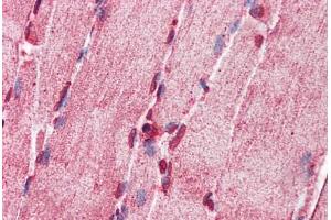 Human Skeletal Muscle: Formalin-Fixed, Paraffin-Embedded (FFPE) (ACSL5 antibody  (AA 470-519))