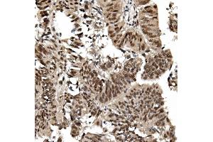 IHC analysis of TIF1 gamma/TRIM33 using anti TIF1 gamma/TRIM33 antibody (ABIN7599621). (TRIM33 antibody  (AA 1001-1127))