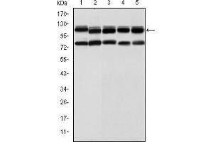 Western blot analysis using BMPR2 mouse mAb against Hela (1), A431 (2), NIH/3T3 (3), Cos7 (4) and PC-12 (5) cell lysate. (BMPR2 antibody)